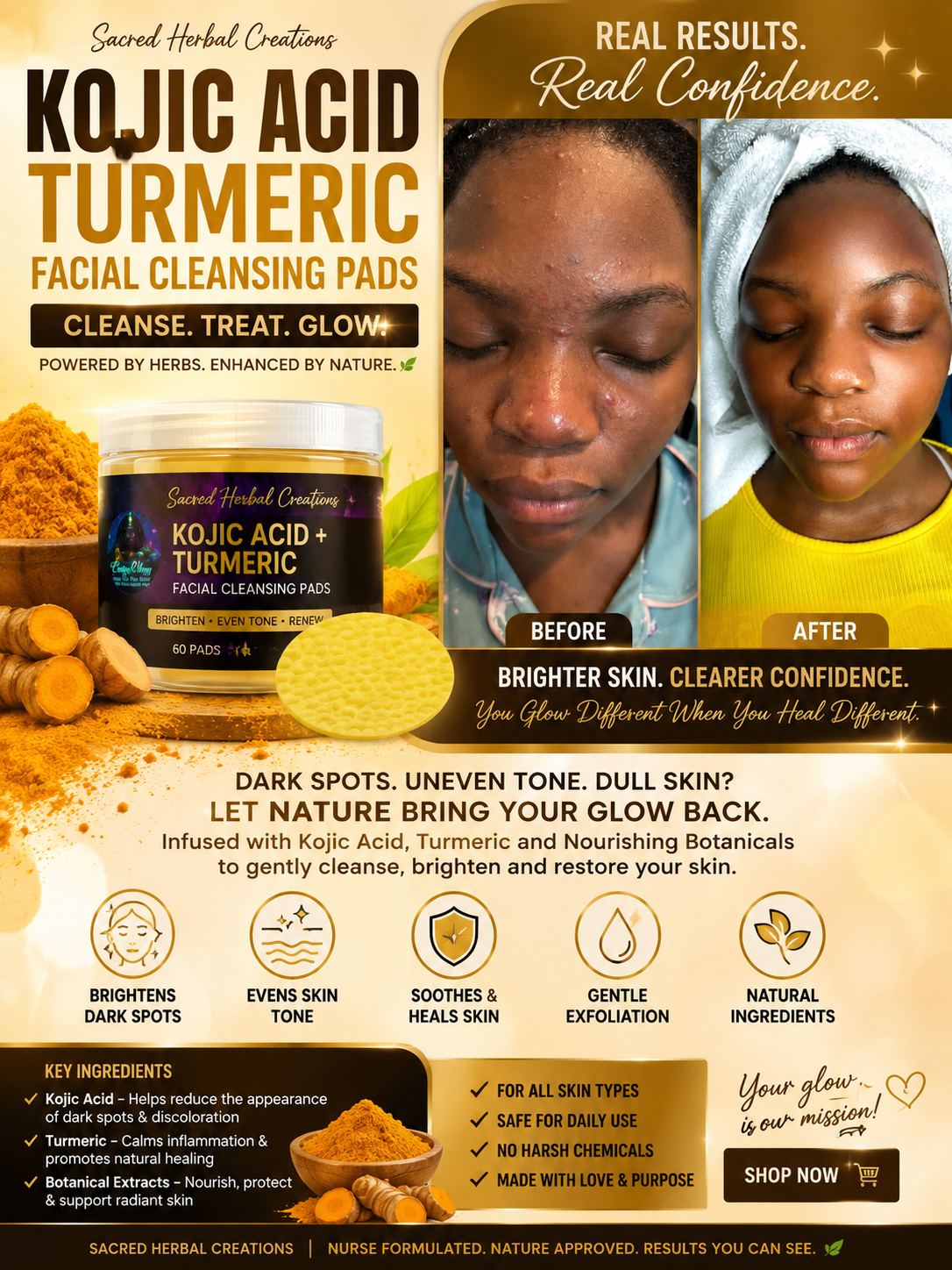Kojic acid and Turmeric cleansing pads with Eczema butter